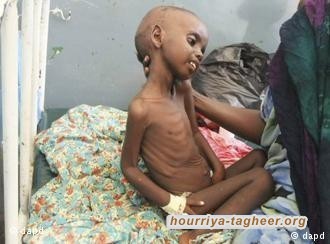 لماذا لا يريد آل سعود ايقاف حرب اليمن؟