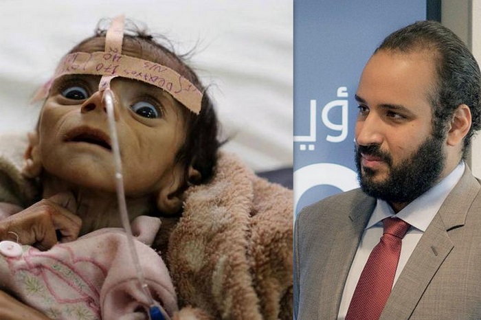 كيف تحدد اليمن مستقبل محمد بن سلمان؟