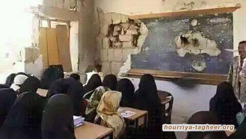 80 % من اليمنيين يعانون نقصاً غذائياً شديداً