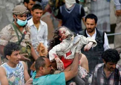 الأمم المتحدة تتخذ اجراءات لإدراج التحالف العربي بقيادة الرياض على قائمتها السوداء لمنتهكي حقوق الأطفال على خلفية حربه في اليمن